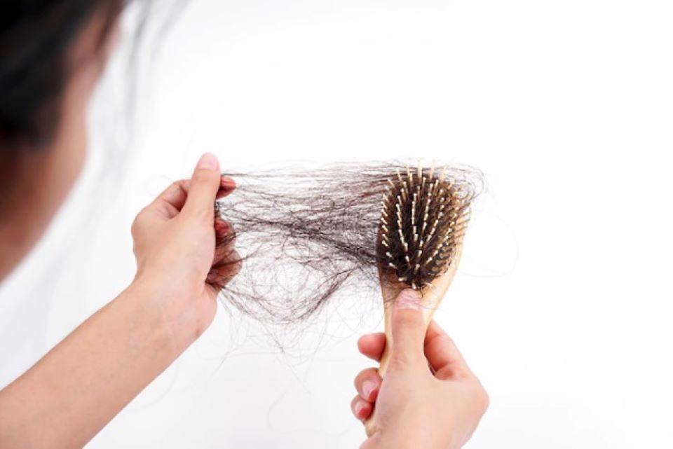 Rụng tóc sinh lý: Rụng bao nhiêu sợi một ngày là bình thường?